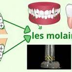 les dents ce11