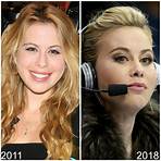 tara lipinski plastic surgery before and after3