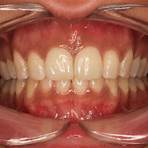 Should I get Invisalign from a dentist or orthodontist?1