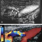 spectral analysis ultrasound3