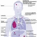 probleme mit der lunge symptome2