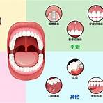 牙周病治療方法 雷射費用2