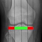 knie anatomie bild4