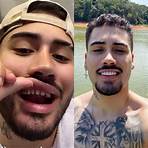 lentes dentes famosos antes e depois4