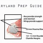 one wing maryland bridge preparation4