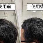 增髮纖維 副作用4