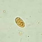 giardia lamblia cyst morphology1