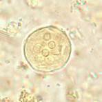 entamoeba coli cyst trophozoite bacteria2