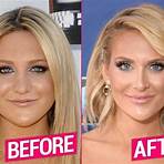 stephanie pratt plastic surgery1