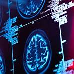 阿茲海默症與腦部真菌感染有什麼關聯?4