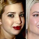 ivanka trump plastic surgery look alikes1