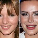 bella thorne plastic surgery lips1