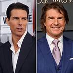 has tom cruise had plastic surgery on his face1