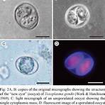 Toxoplasma gondii wikipedia1