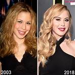 tara lipinski plastic surgery before and after1