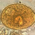 is balantidium coli a ciliate plant3