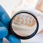 牙周病治療方法 健保2