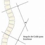 cobb angle4