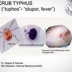 scrub typhus ppt presentation examples3