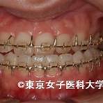 植牙後遺症4