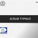 scrub typhus ppt presentation examples4