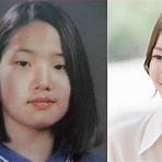lee sae-in plastic surgery2