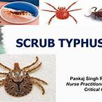 scrub typhus ppt free2