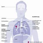 probleme mit der lunge symptome3
