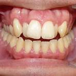 Should I get Invisalign from a dentist or orthodontist?2