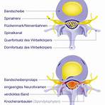 spinalkanalstenose hws symptome1