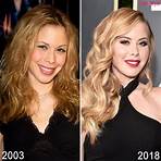 tara lipinski plastic surgery before and after3