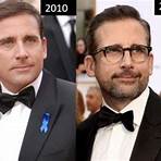 How many grafts did Steve Carell need?4