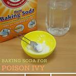 prickly heat rash remedies with baking soda4