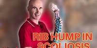 RIB HUMPS, What Are They And What To Do About It #scoliosis