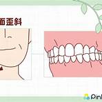 正顎手術 blog2