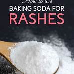 prickly heat rash remedies with baking soda2